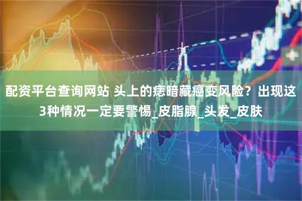 配资平台查询网站 头上的痣暗藏癌变风险？出现这3种情况一定要警惕_皮脂腺_头发_皮肤